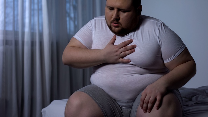 what makes you more likely to have sleep apnea
